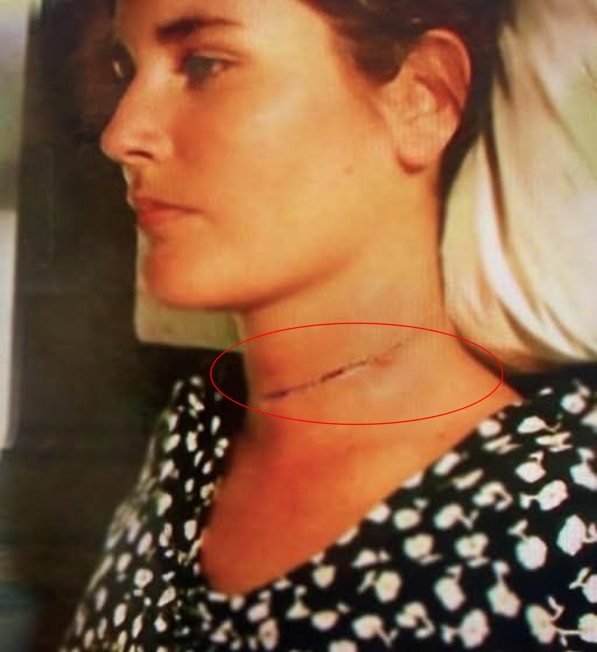 She Held Her Own Head and Walked: The Night Alison Refused to Die